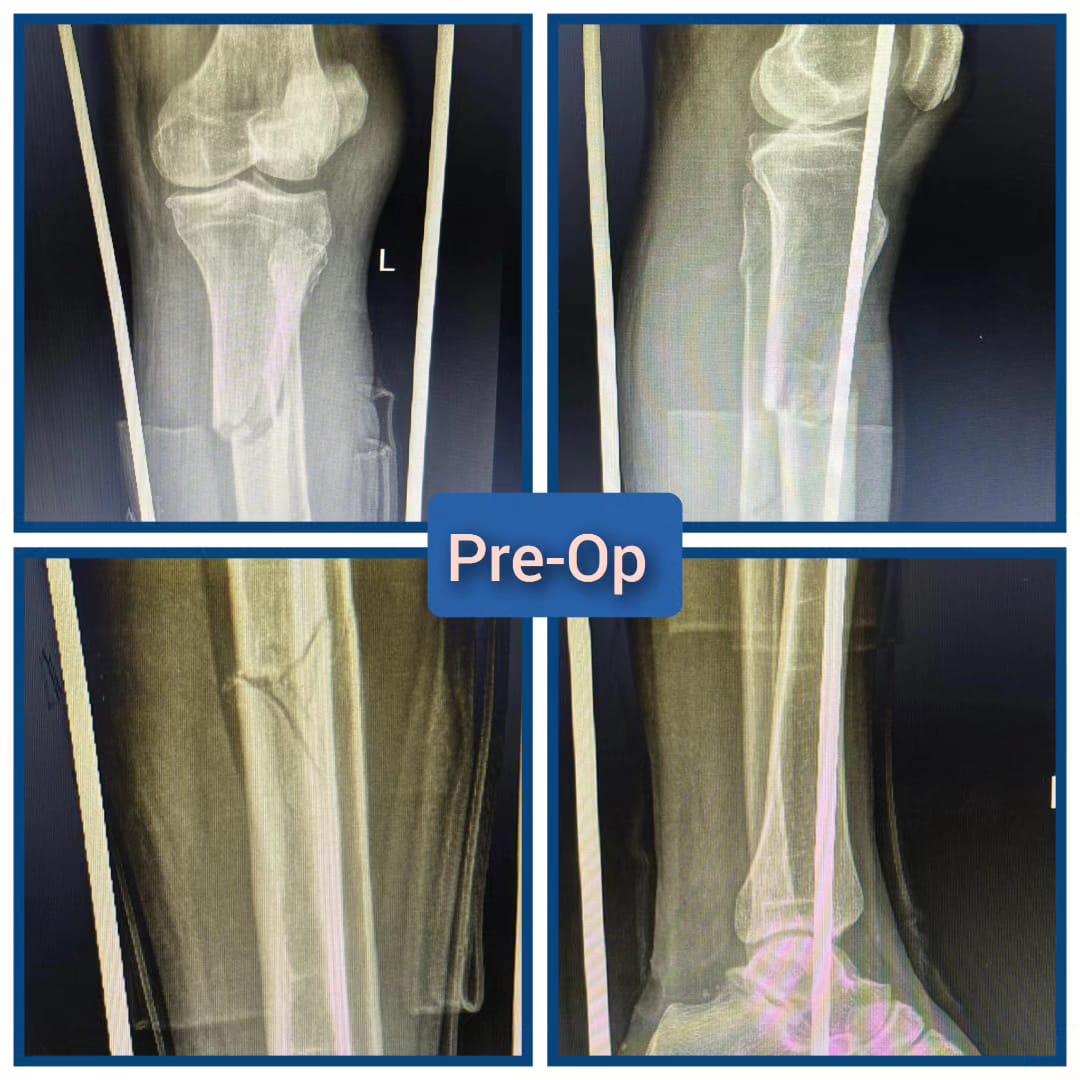 preop02